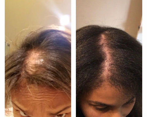 Botanical Hair Elixir - Luxury 3-in-1 Scalp & Hair Oil